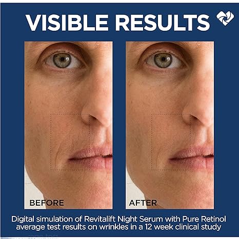 L'Oréal - Revitalift 0.3% Pure Retinol Night Serum 30ml - Ministry of Skin