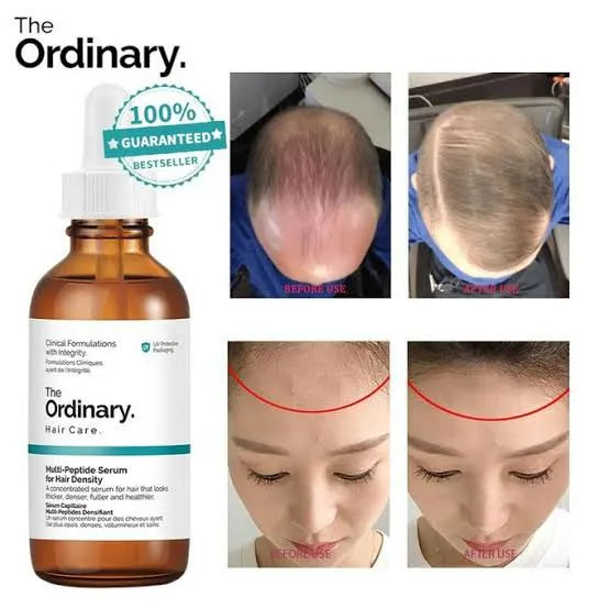The Ordinary - Multi Peptide Serum for Hair Density - 60ml - Ministry of Skin