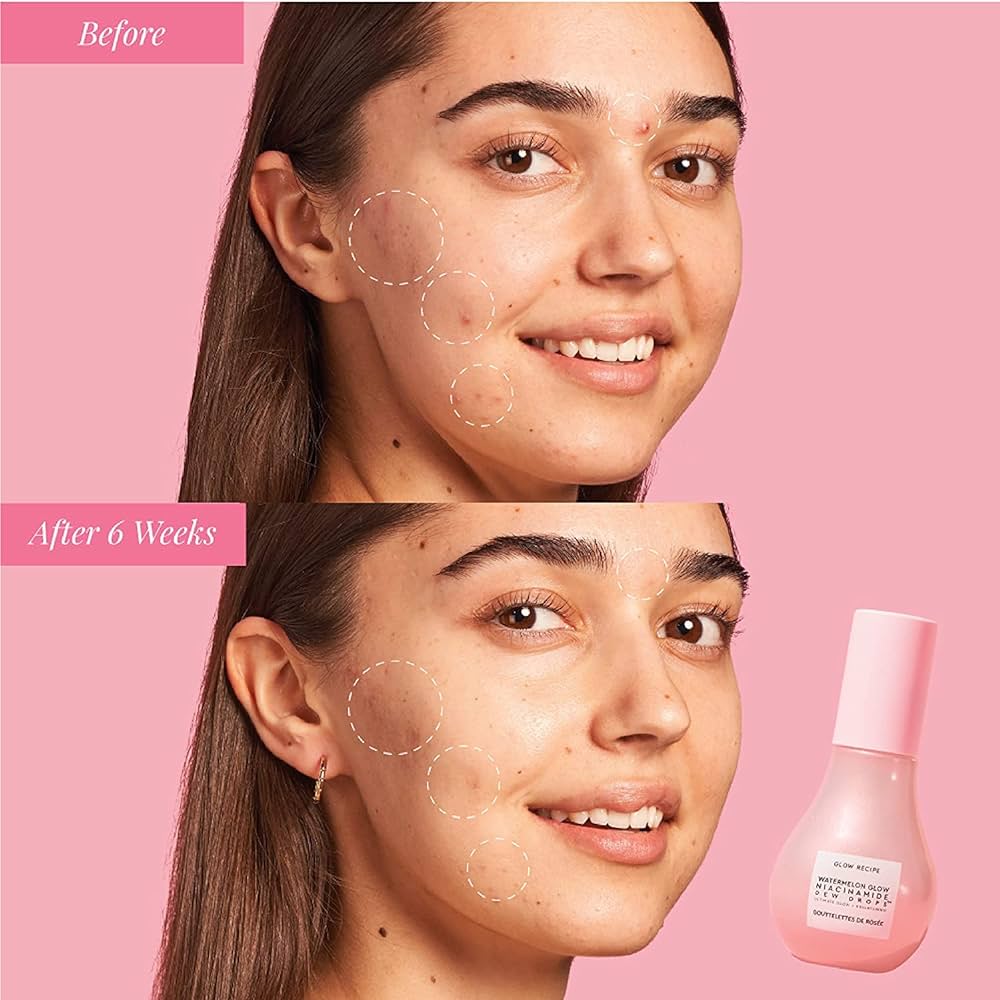 GLOW RECEIPE - Watermelon Glow Niacinamide Dew Drops Serum - 40ml - Ministry of Skin