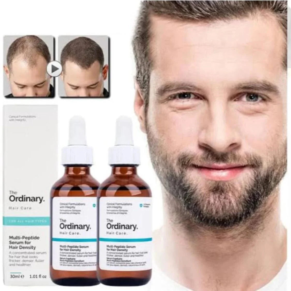 The Ordinary - Multi Peptide Serum for Hair Density - 60ml - Ministry of Skin