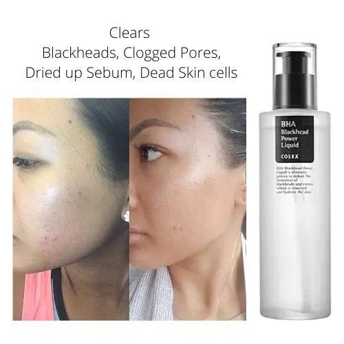 Cosrx - BHA Blackhead Power Liquid - 100ml - Ministry of Skin