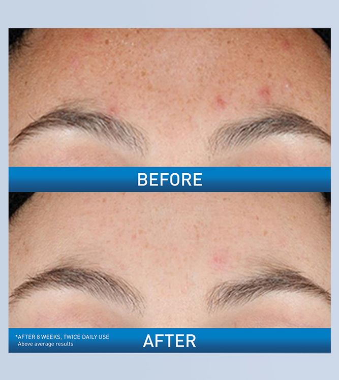 Cerave - Resurfacing Retinol Serum - Ministry of Skin