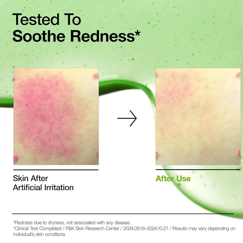 Anua - Azelaic Acid 10 Hyaluron Redness Soothing Serum - 30ml