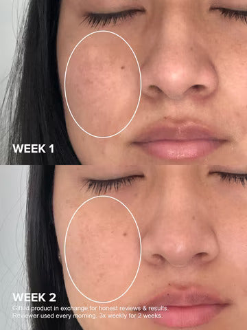 Paula's Choice - Niacinamide 20% Treatment - Ministry of Skin