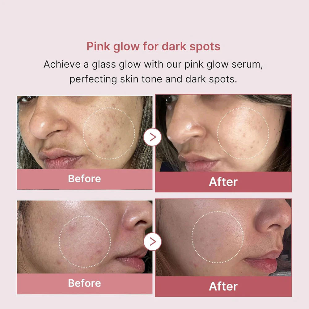 Medicube PDRN Pink Peptide Serum - 30ml - Ministry of Skin
